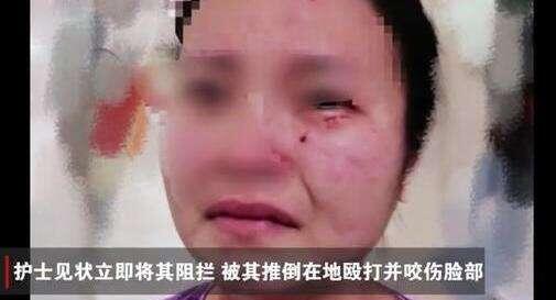 广州公开回应:被咬伤的护士检测未见异常